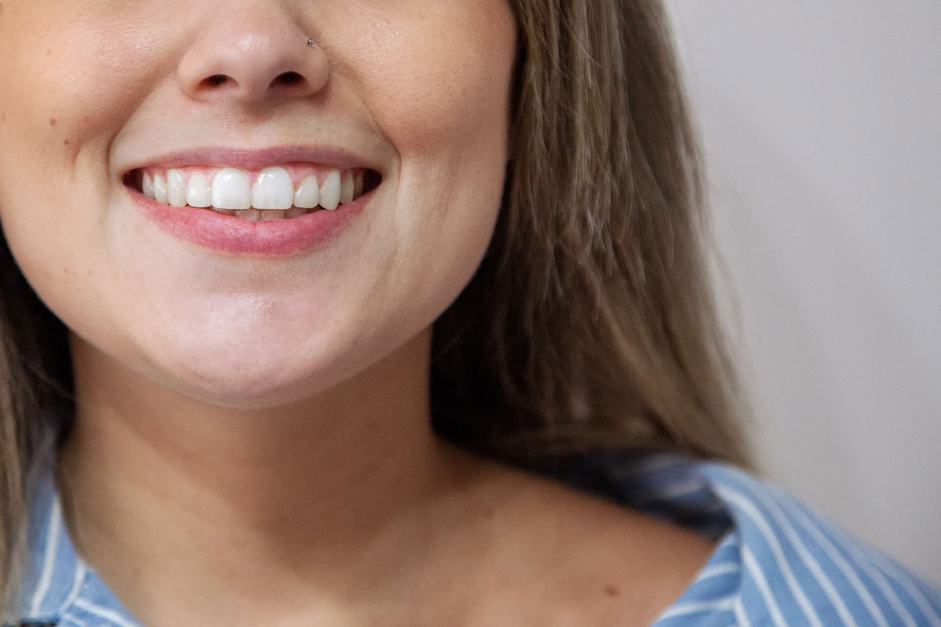 Pide tu cita en Clínica Dentalbeth y luce tu mejor sonrisa