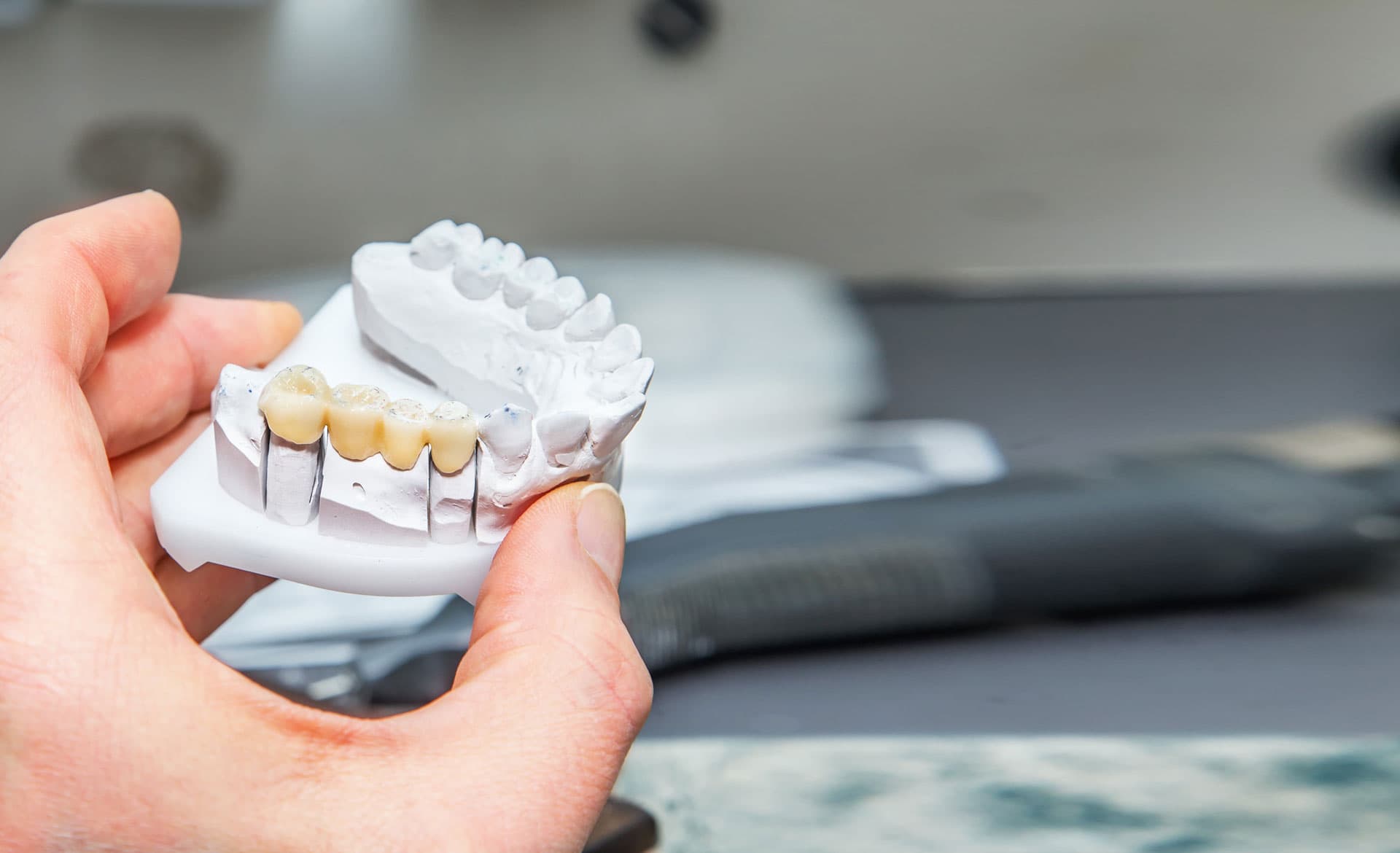 ¡La primera consulta es la clave!